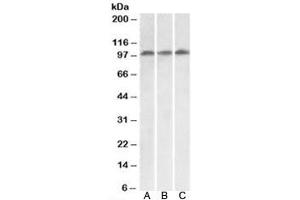 Western blot testing of HeLa [A], HepG2 [B] and Jurkat [C] lysates with VPS16 antibody at 0. (VPS16 Antikörper  (Isoform 1))