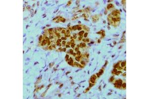 Immunohistochemistry (Formalin-fixed Paraffin-embedded Sections) (IHC (fp)) image for anti-ELAV (Embryonic Lethal, Abnormal Vision, Drosophila)-Like 1 (Hu Antigen R) (ELAVL1) antibody (ABIN577055)
