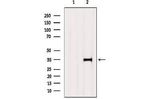 Western blot analysis of extracts from 3t3, using SULT2A1 Antibody. (SULT2A1 Antikörper  (C-Term))
