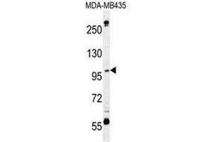 CA026 Antibody (N-term) western blot analysis in MDA-MB435 cell line lysates (35µg/lane). (SWT1 Antikörper  (N-Term))