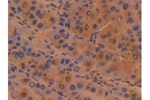 DAB staining on IHC-P; Samples: Human Liver Tissue (Sialoadhesin/CD169 Antikörper  (AA 34-240))