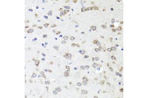 Immunohistochemistry of paraffin-embedded mouse brain using IGFBP5 antibody (ABIN6292146) at dilution of 1:100 (40x lens).