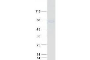 Western Blotting (WB) image for Nuclear Receptor Subfamily 4, Group A, Member 2 (NR4A2) protein (Myc-DYKDDDDK Tag) (ABIN2727592)