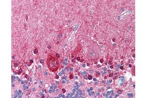 Immunohistochemistry (IHC) image for anti-Potassium Large Conductance Calcium-Activated Channel, Subfamily M, alpha Member 1 (KCNMA1) (Internal Region) antibody (ABIN1048988)