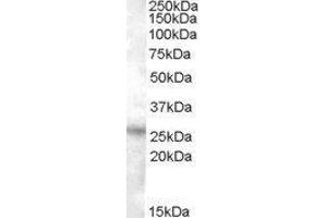 Western Blotting (WB) image for Ras Association (RalGDS/AF-6) Domain Family Member 3 (RASSF3) peptide (ABIN369335) (Ras Association (RalGDS/AF-6) Domain Family Member 3 (RASSF3) Peptid)