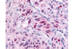 Immunohistochemistry (IHC) image for anti-Nuclear Receptor Subfamily 1, Group D, Member 2 (NR1D2) (Ligand Binding Domain) antibody (ABIN1049132)