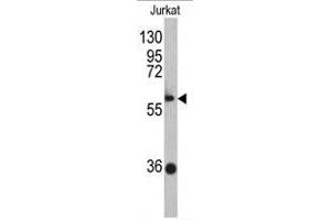 Western blot analysis of ZBTB2 antibody (C-term) in Jurkat cell line lysates (35ug/lane). (ZBTB2 Antikörper  (C-Term))