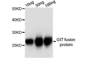 Western blot analysis of over-expressed GST fusion protein using GST-tag antibody. (GST Antikörper)
