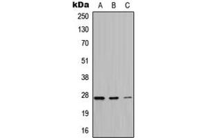Western blot analysis of ATP6 expression in HeLa (A), A549 (B), PC12 (C) whole cell lysates. (MT-ATP6 Antikörper  (Center))