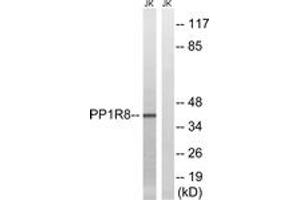 Western blot analysis of extracts from Jurkat cells, using PPP1R8 Antibody. (PPP1R8 Antikörper  (AA 196-245))