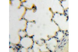 IHC-P analysis of Lung tissue, with DAB staining. (TLR7 Antikörper  (AA 890-1037))