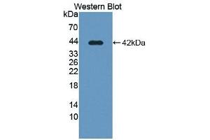 Detection of Recombinant SLC39A6, Human using Polyclonal Antibody to Solute Carrier Family 39, Member 6 (SLC39A6) (SLC39A6 Antikörper  (AA 29-325))
