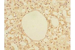 Immunohistochemistry of paraffin-embedded human adrenal gland tissue using ABIN7172318 at dilution of 1:100 (TRIAP1 Antikörper  (AA 1-76))