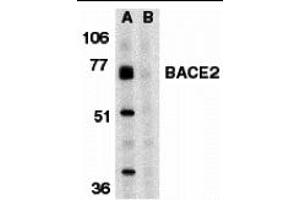 Western Blotting (WB) image for anti-beta-Site APP-Cleaving Enzyme 2 (BACE2) (C-Term) antibody (ABIN1030277) (BACE2 Antikörper  (C-Term))