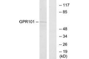 Western blot analysis of extracts from COS7 cells, using GPR101 Antibody. (GPR101 Antikörper  (AA 451-500))