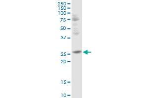 Western Blotting (WB) image for anti-Tissue Factor Pathway Inhibitor 2 (TFPI2) (AA 1-235) antibody (ABIN521716)