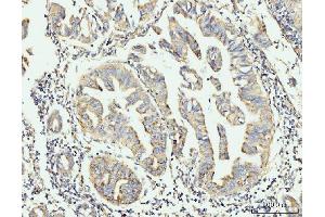 IHC analysis of GRPEL1 using anti-GRPEL1 antibody (ABIN7602643).