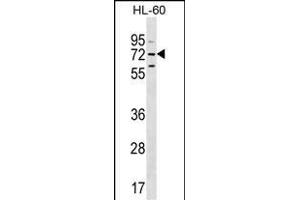 MBTD1 Antibody (C-term) (ABIN655319 and ABIN2844896) western blot analysis in HL-60 cell line lysates (35 μg/lane). (MBTD1 Antikörper  (C-Term))