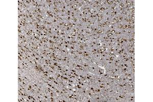 IHC analysis of FOXP1 using anti-FOXP1 antibody (ABIN7602780). (FOXP1 Antikörper  (C-Term))