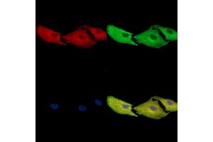 ABIN7097118 and ABIN7101185 staining  cells by IF/ICC.