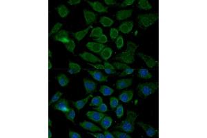 Immunofluorescence analysis of L929 cells using Bcl-2 antibody (ABIN3016825, ABIN3016826, ABIN3016827 and ABIN6219850) at dilution of 1:100. (Bcl-2 Antikörper  (AA 81-131))