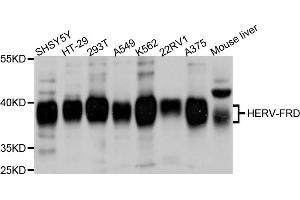 Western blot analysis of extracts of various cell lines, using ERVFRD-1 antibody (ABIN6003860) at 1/1000 dilution. (HERV-FRD Provirus Ancestral Env Polyprotein (Herv-frd) Antikörper)