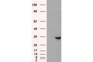 Western Blotting (WB) image for anti-Annexin A10 (ANXA10) antibody (ABIN1496651) (Annexin a10 Antikörper)