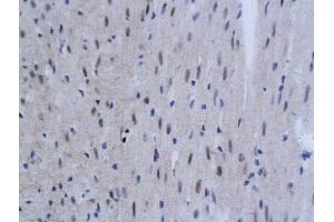 Formalin-fixed and paraffin embedded mouse myocardial tissue labeled with Anti SnoN Polyclonal Antibody, Unconjugated  followed by conjugation to the secondary antibody and DAB staining