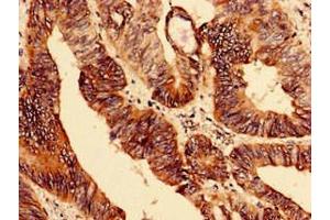 Immunohistochemistry (IHC) image for anti-ELAV (Embryonic Lethal, Abnormal Vision, Drosophila)-Like 2 (Hu Antigen B) (ELAVL2) (AA 4-356) antibody (ABIN7151479)