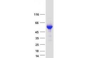 Western Blotting (WB) image for Jumonji Domain Containing 5 (JMJD5) (Transcript Variant 1) protein (Myc-DYKDDDDK Tag) (ABIN2723936)