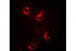 Immunofluorescent analysis of Alpha-crystallin A staining in Hela cells. (CRYAA Antikörper)