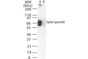 Image no. 1 for anti-SARS-Coronavirus Spike Protein (SARS-CoV S) (AA 19-35) antibody (ABIN199980) (SARS-CoV Spike Antikörper  (AA 19-35))