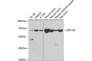 Western blot analysis of extracts of various cell lines using ZNF195 Polyclonal Antibody at dilution of 1:1000. (ZNF195 Antikörper)