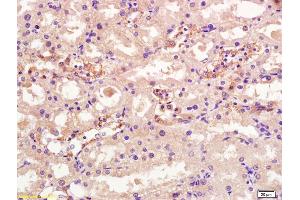 Formalin-fixed and paraffin embedded rat kidney labeled with Rabbit Anti OSTM1 Polyclonal Antibody, Unconjugated (ABIN1387308) at 1:200 followed by conjugation to the secondary antibody and DAB staining (OSTM1 Antikörper  (AA 21-120))