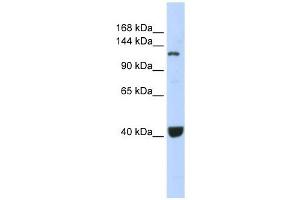 PIWIL1 antibody used at 1 ug/ml to detect target protein. (PIWIL1 Antikörper)