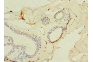 Immunohistochemistry (IHC) image for anti-Solute Carrier Family 25 (Mitochondrial Carrier, Adenine Nucleotide Translocator), Member 4 (SLC25A4) (AA 40-74) antibody (ABIN7143534)