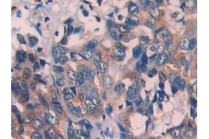 Used in DAB staining on fromalin fixed paraffin- embedded kidney tissue (ECT2 Antikörper  (AA 453-647))