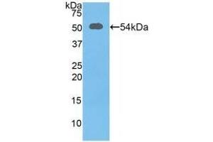 Detection of Recombinant SLC3A2, Mouse using Polyclonal Antibody to Solute Carrier Family 3, Member 2 (SLC3A2) (SLC3A2 Antikörper  (AA 285-521))