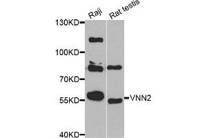 Western blot analysis of extracts of Raji and rat testis cell lines, using VNN2 antibody. (VNN2 Antikörper)