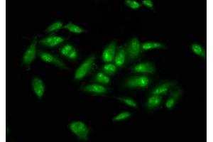 Immunofluorescence staining of Hela cells with ABIN7173496 at 1:66, counter-stained with DAPI. (NSUN2 Antikörper  (AA 432-509))