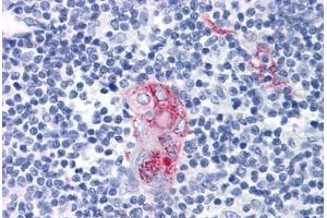Human Thymus: Formalin-Fixed, Paraffin-Embedded (FFPE) (CD1d Antikörper)