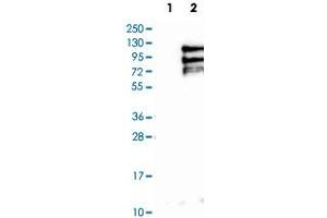 Western Blot analysis of Lane 1: negative control (vector only transfected HEK293T cell lysate) and Lane 2: over-expression lysate (co-expressed with a C-terminal myc-DDK tag in mammalian HEK293T cells) with TPX2 polyclonal antibody . (TPX2 Antikörper)