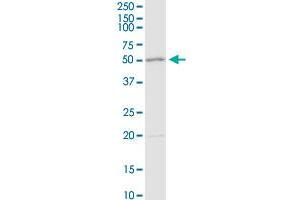 Western Blotting (WB) image for anti-Adenosine Deaminase (ADA) (AA 1-363) antibody (ABIN513110)