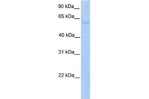 WB Suggested Anti-PWP1 Antibody Titration:  0. (PWP1 Antikörper  (C-Term))