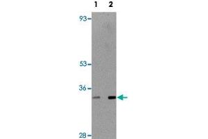 Western blot analysis of rat thymus tissue with TMEM38B polyclonal antibody  at (Lane 1) 1 and (Lane 2) 2 ug/mL dilution. (TMEM38B Antikörper  (C-Term))