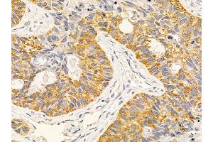 anti-Protein Phosphatase, Mg2+/Mn2+ Dependent, 1E (PPM1E) (Internal Region) antibody
