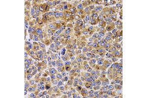 Immunohistochemistry of paraffin-embedded mouse cancer using UBE2R2 antibody (ABIN5975512) at dilution of 1/100 (40x lens).