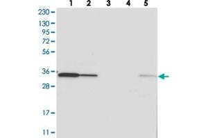 Western blot analysis of Lane 1: RT-4, Lane 2: U-251 MG, Lane 3: Human Plasma, Lane 4: Liver, Lane 5: Tonsil with C1orf74 polyclonal antibody  at 1:250-1:500 dilution. (C1ORF74 Antikörper)