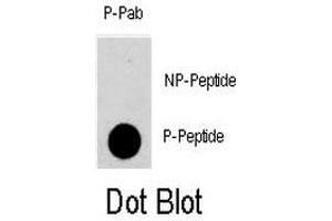 Dot blot analysis of PKMYT1 (phospho T495) polyclonal antibody  on nitrocellulose membrane. (PKMYT1 Antikörper  (pThr495))