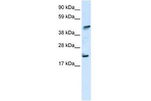 WB Suggested Anti-ZNFN1A5 Antibody Titration: 0. (IKZF5 Antikörper  (N-Term))